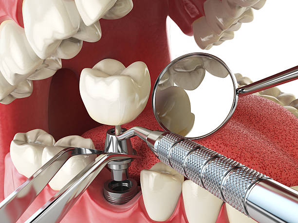 Best Tooth Infection Emergency Dentist  in Crooksville, OH